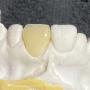 Foto 1:  JCM Prótese Dental